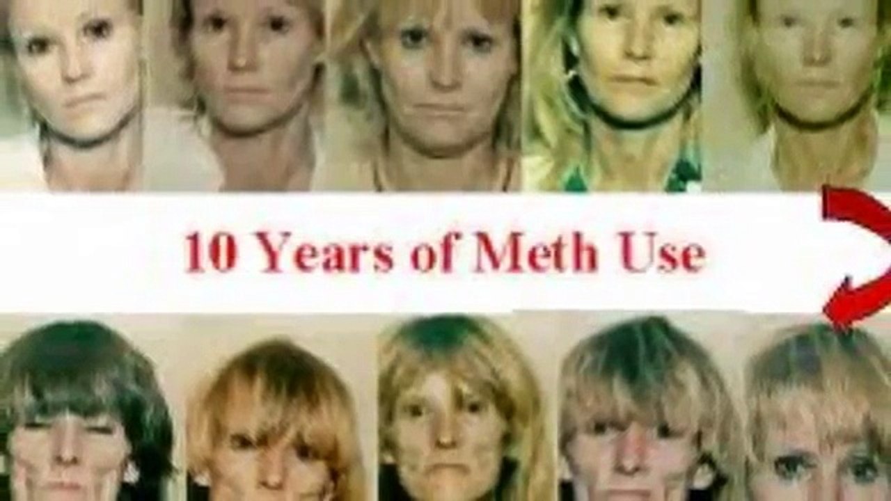 Crystal Meth Before & After and its Devastating Effects