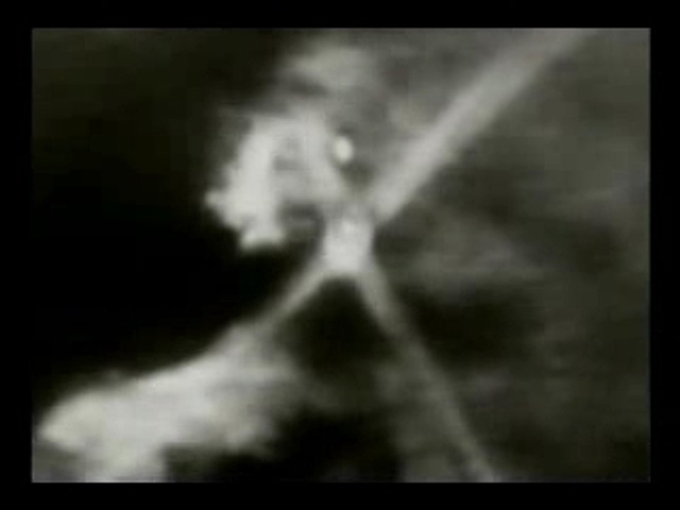 The Battle of Los Angeles