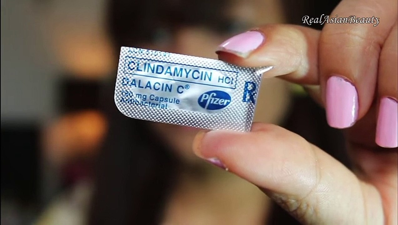 Inexpensive Acne Solution 2016