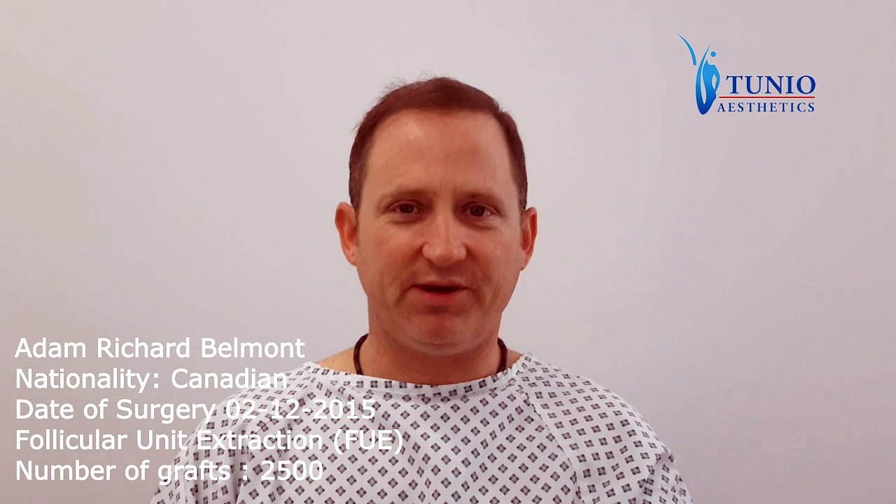 Adam Richard Belmont Interview Before FUE Hair Transplant Surgery Dated 02-12-2015