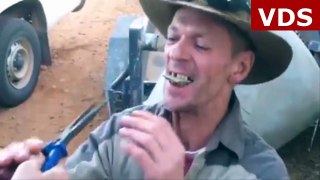 Real-life Crocodile Dundee demonstrates some Outback dentistry that will make your toes curl