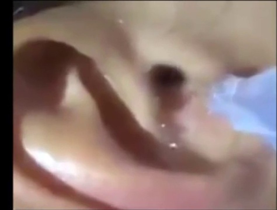 عنكبوت يدخل أذن رجل وهو نائم