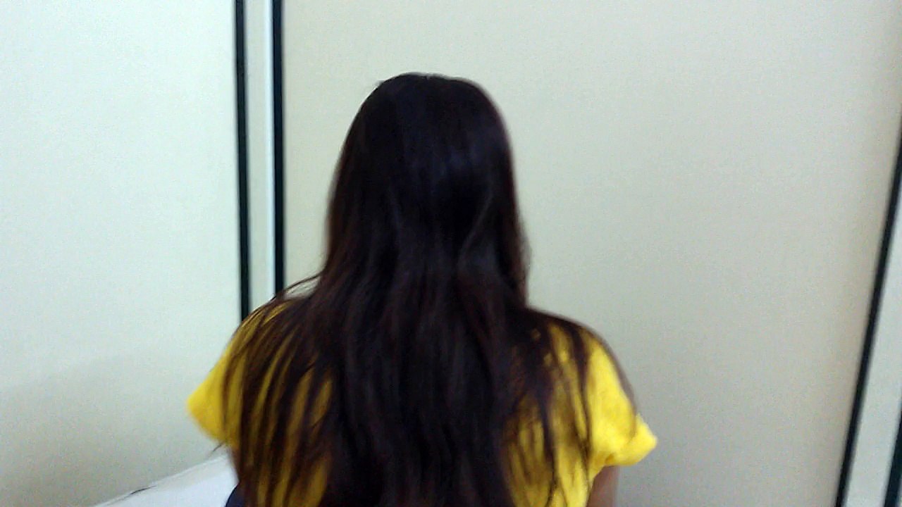 Hairline International Clinic Reviews-Hair Loss Treatment Bangalore