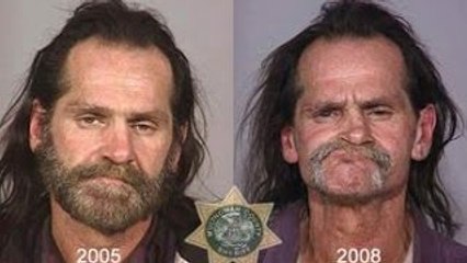 The 3 Most Dangerous Drugs in the World 🚨 | Morphine, Heroin & More