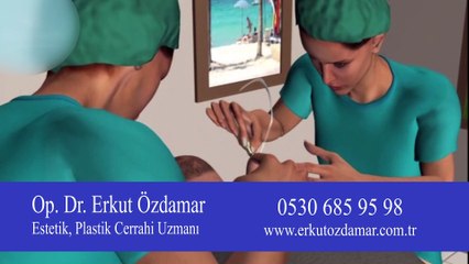 FUE tekniğinden daha ileri bir saç ekim yöntemi var mı?