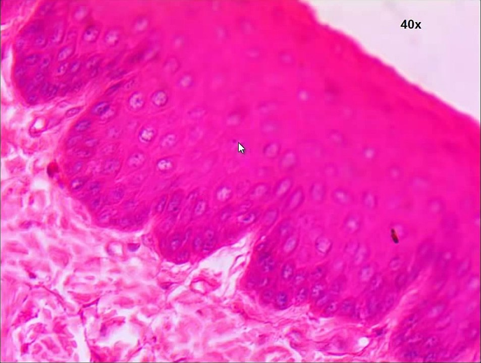 Slide Stratified Squamous Epithelium