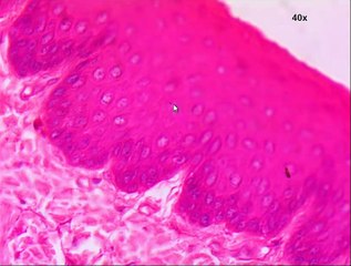 Slide Stratified Squamous Epithelium