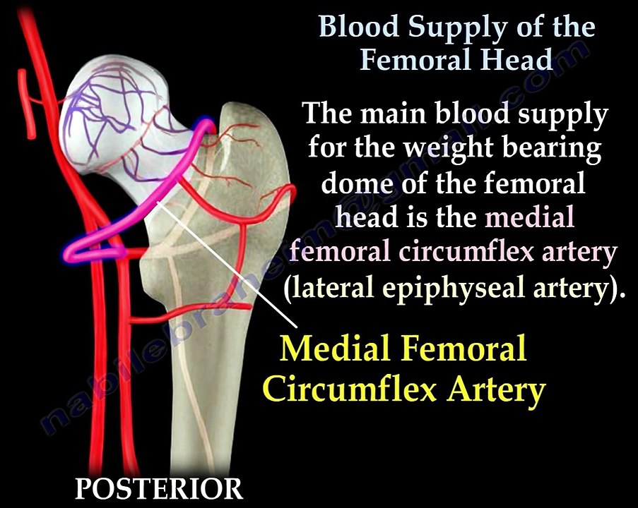 Avascular Necrosis, Blood Supply Femoral Head- Everything You Need To ...