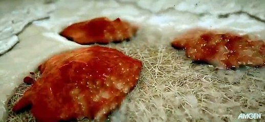 Bone Remodeling and Modeling