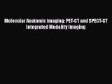 PDF Download Molecular Anatomic Imaging: PET-CT and SPECT-CT Integrated Modality Imaging Read