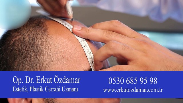 Saç ekimi yaptırabilmek için saçların tamamen dökülmesini beklemek gerekli midir