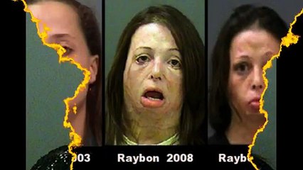 Crystal Meth: Methamphetamine (Before and After) Part 2