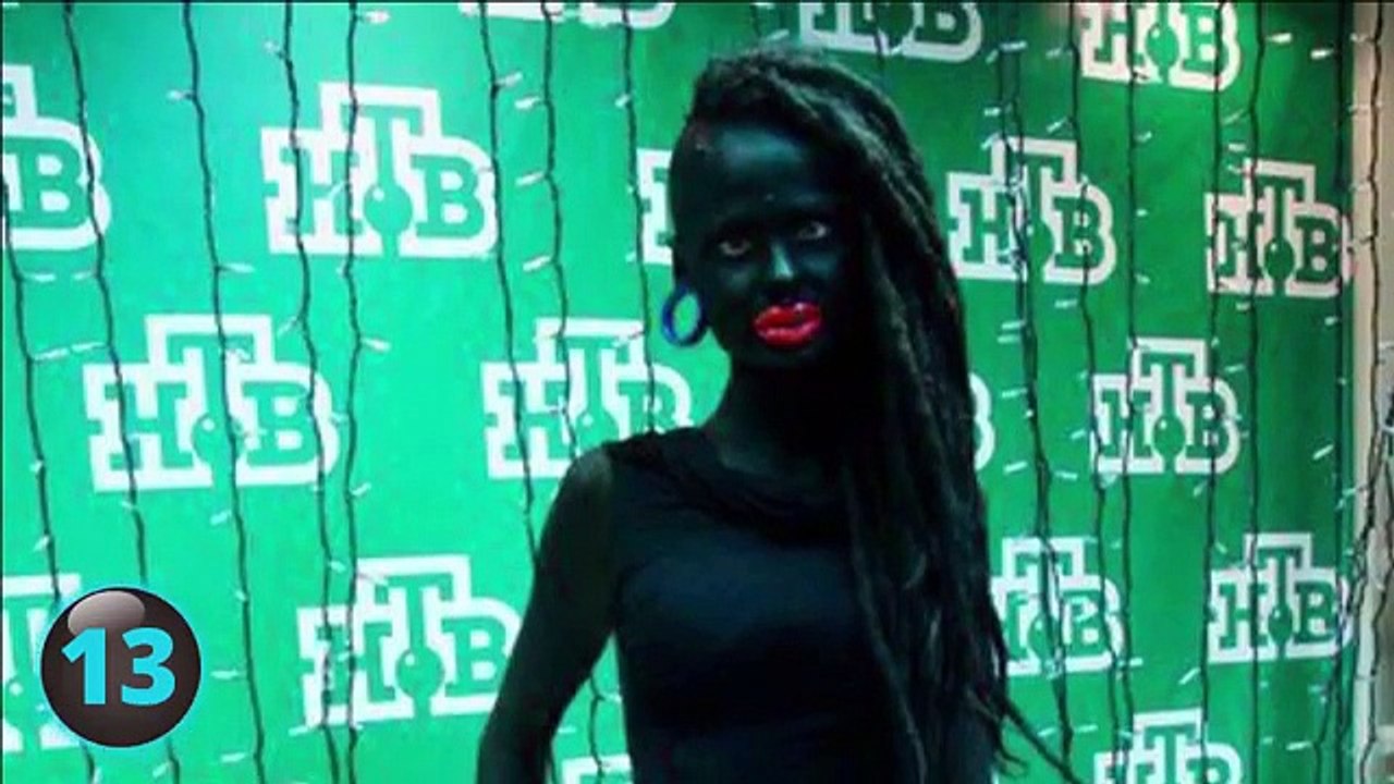 Worst Plastic Surgeries Ever!