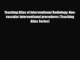 PDF Download Teaching Atlas of Interventional Radiology: Non-vascular interventional procedures