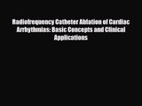 PDF Download Radiofrequency Catheter Ablation of Cardiac Arrhythmias: Basic Concepts and Clinical
