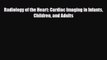 PDF Download Radiology of the Heart: Cardiac Imaging in Infants Children and Adults Read Online