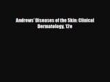 PDF Download Andrews' Diseases of the Skin: Clinical Dermatology 12e PDF Online