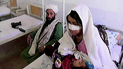 Mulher que teve o nariz cortado pede apoio para fazer cirurgia