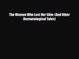 PDF Download The Woman Who Lost Her Skin: (And Other Dermatological Tales) Read Full Ebook