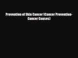 PDF Download Prevention of Skin Cancer (Cancer Prevention-Cancer Causes) Read Online