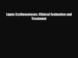 PDF Download Lupus Erythematosus: Clinical Evaluation and Treatment Read Online