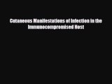 PDF Download Cutaneous Manifestations of Infection in the Immunocompromised Host Read Full