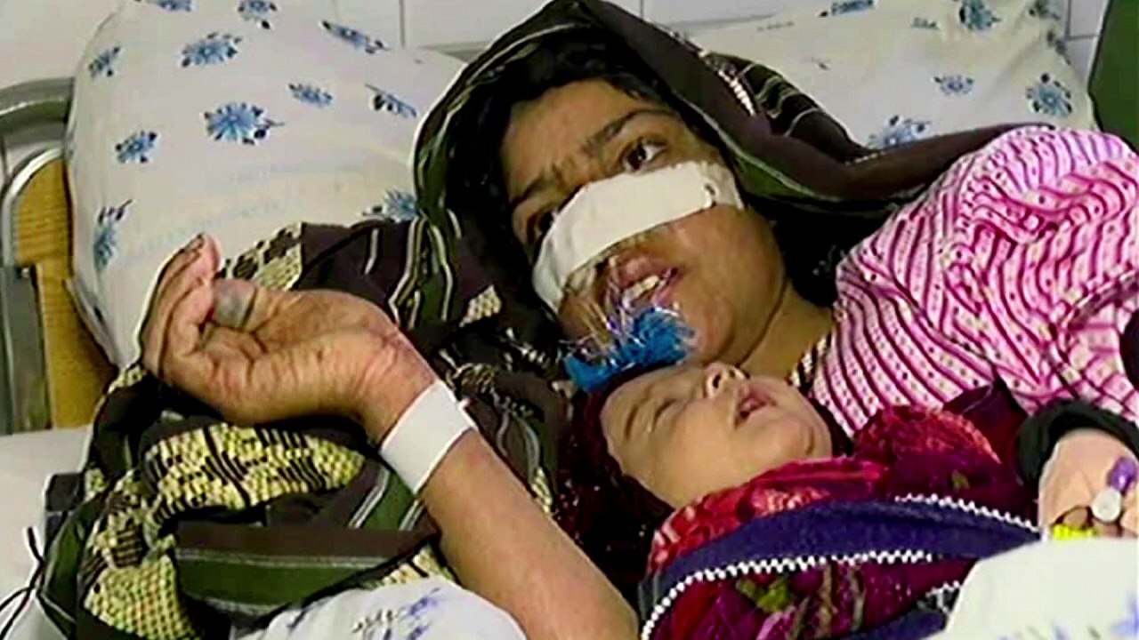Afghane schneidet Ehefrau die Nase ab