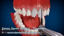 Ortho Treatment in Chennai | Best Dental Hospital