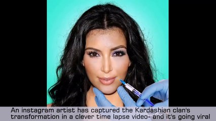 Kylie Jenner and Kim Kardashian’s Transformation Surgery In Time Lapse