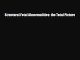 PDF Download Structural Fetal Abnormalities: the Total Picture Read Full Ebook