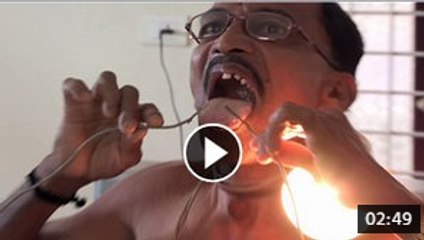OMG! Man Who Does not Feel Electric Shock