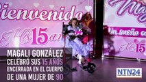 Conozca a Magali, la niña colombiana con progeria que cumple 15 años con aspecto de 90