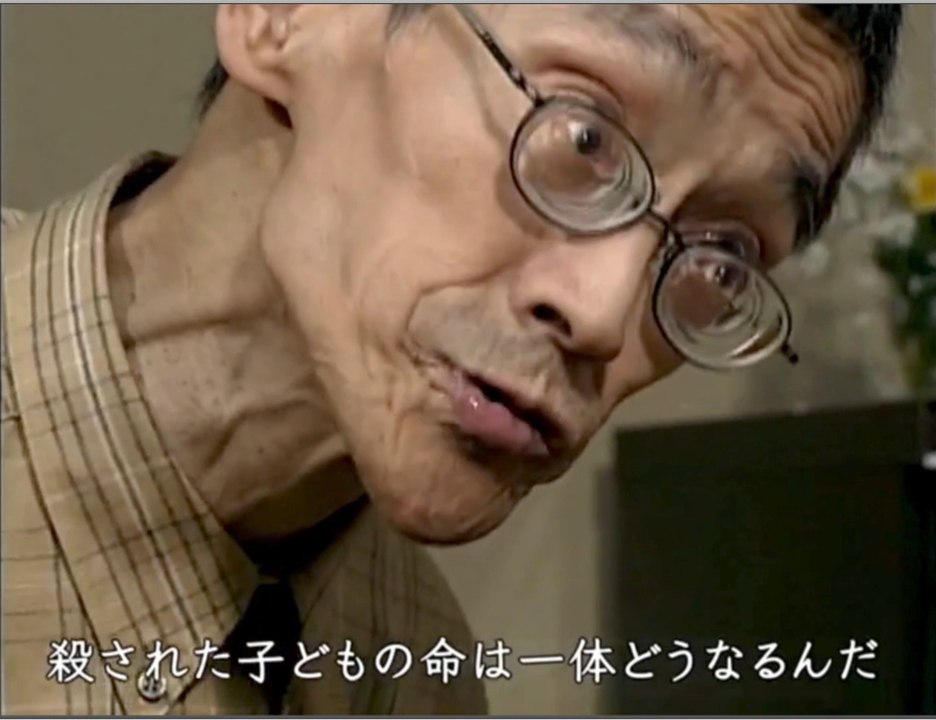 日本人は何をめざしてきたのか６-前半／障害者自立生活への苦闘〜共に生きる社会を求めて