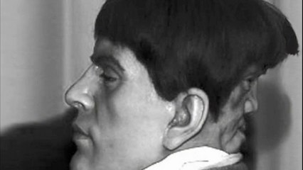 The Man With Two Faces