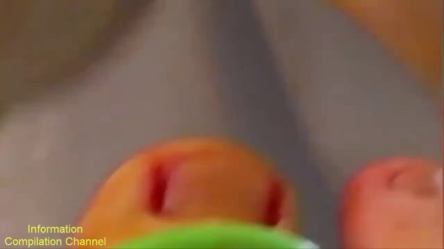 Toenail fungus treatment compilation | Torn toenail removal vol2