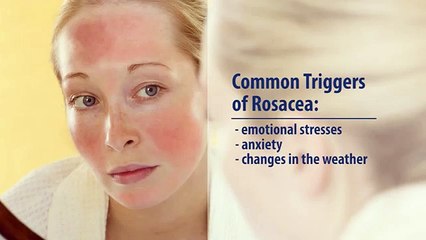 Common Skin Disorders- Rosacea
