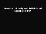 PDF Download Severe Burns: A Family Guide To Medical And Emotional Recovery PDF Online