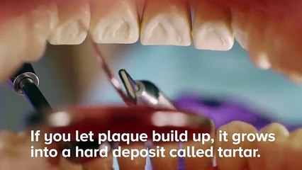 11 Gross Facts About Your Teeth