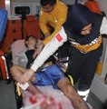 Polis, Kendilerine Bomba Atan Genci Hastaneye Yetiştirdi