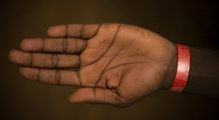 Galler'de Sığınmacılara "Renkli Bileklik" Uygulaması