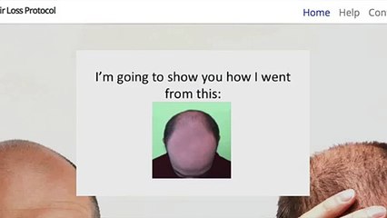 Latest Hair Loss Protocol eBook Review by Real Customers