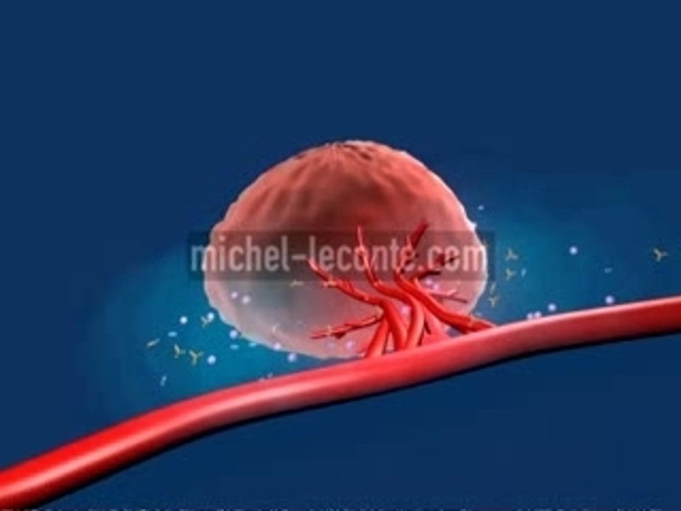 ANTIANGIOGENIC THERAPY