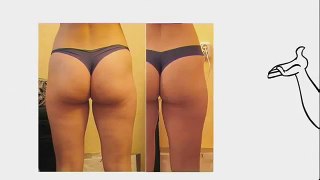 Cellulite Factor Solution by Dr. Charles Livingston