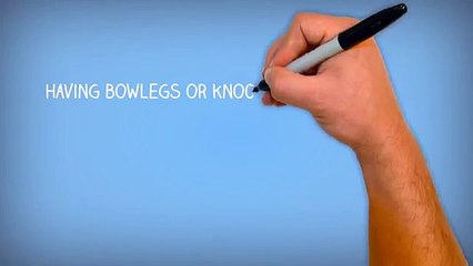 Bow Legs No More   Hot For Summer 2015