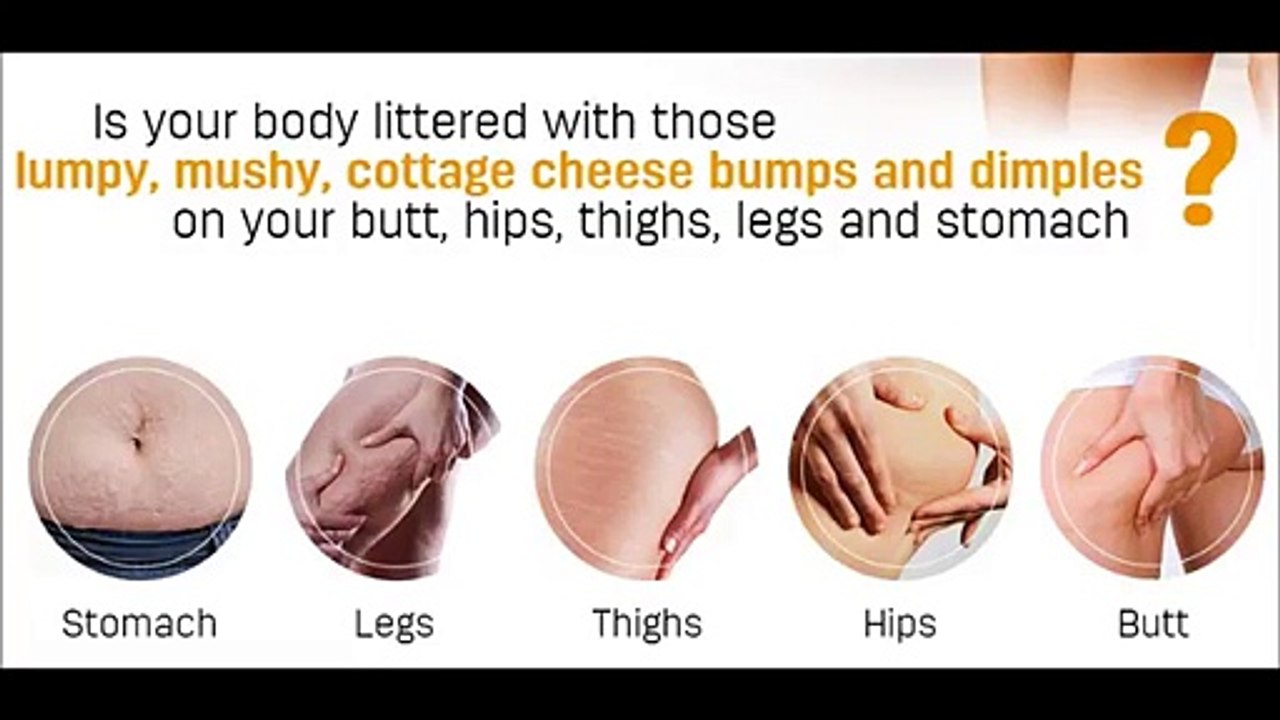 The Cellulite Factor Solution