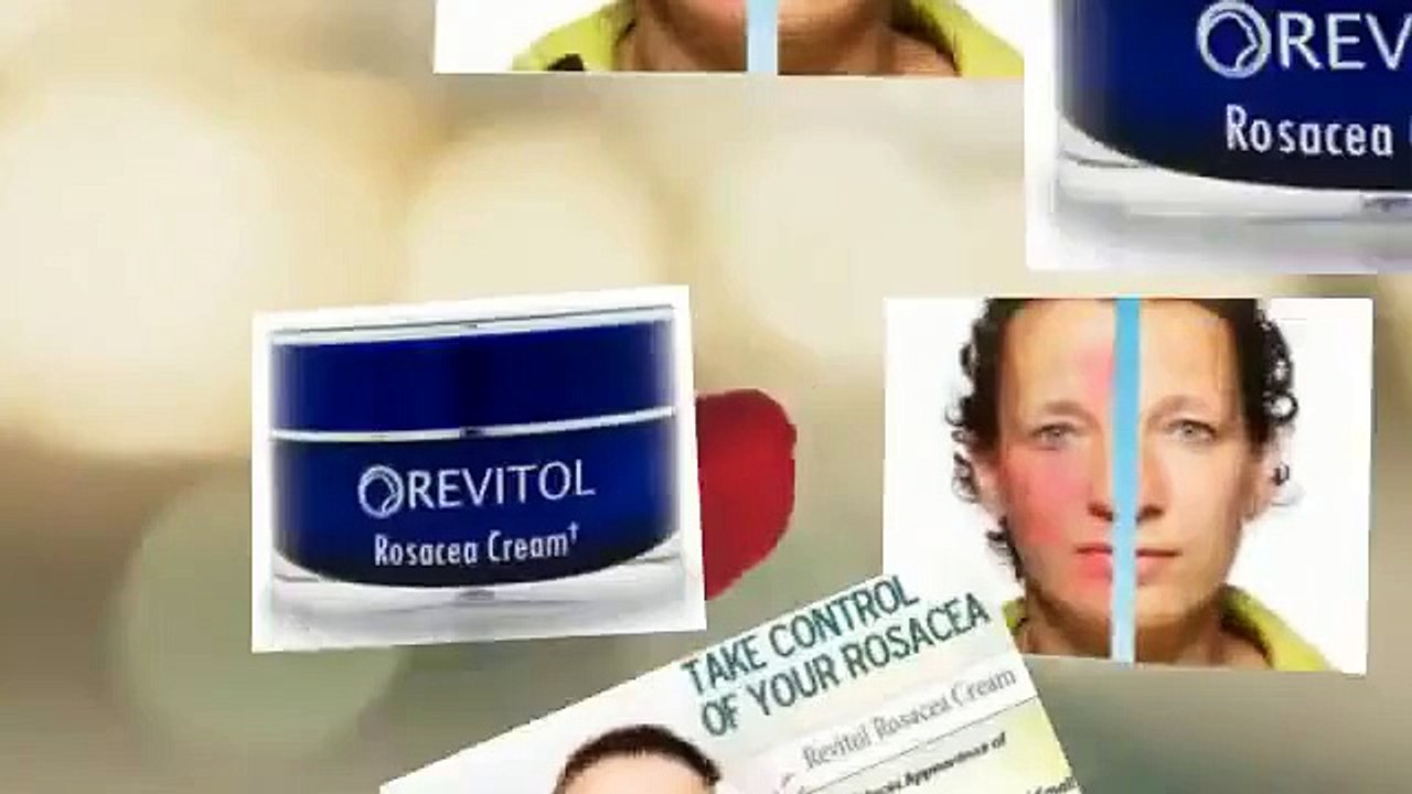 Treatment for Rosacea