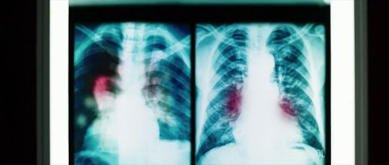 DEADPOOL TV Spot #10 (2016) Ryan Reynolds Superhero Movie HD