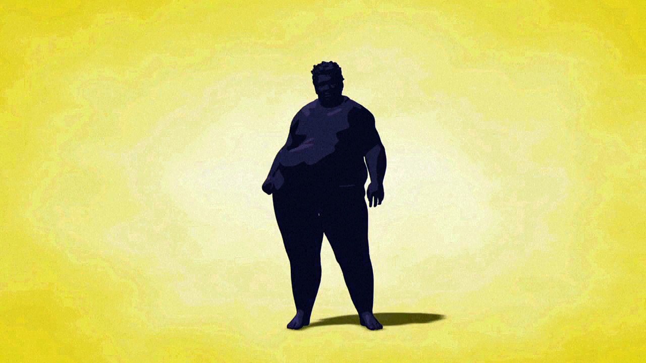 Obesidade