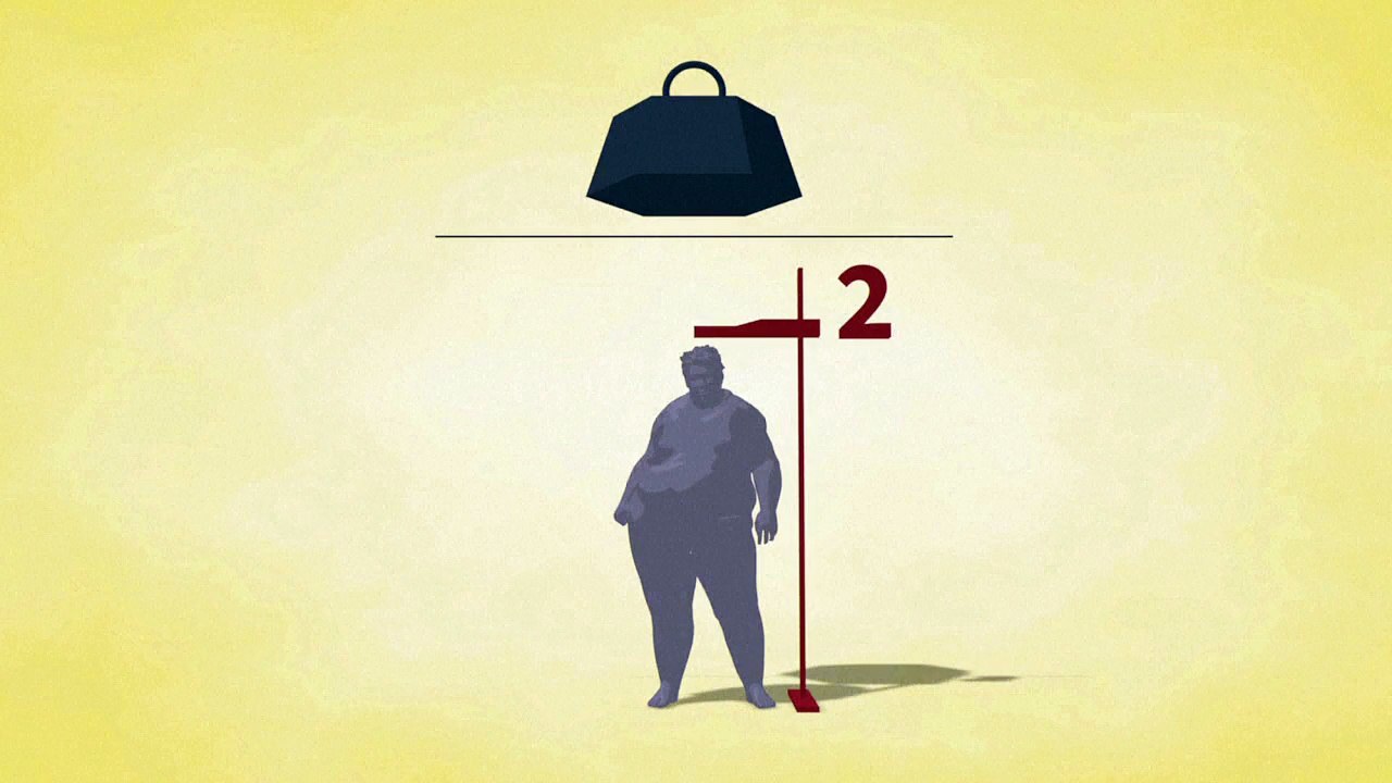 La obesidad