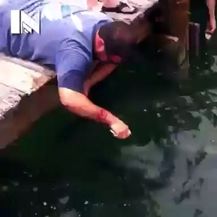 Fish Grabs Man's Arm